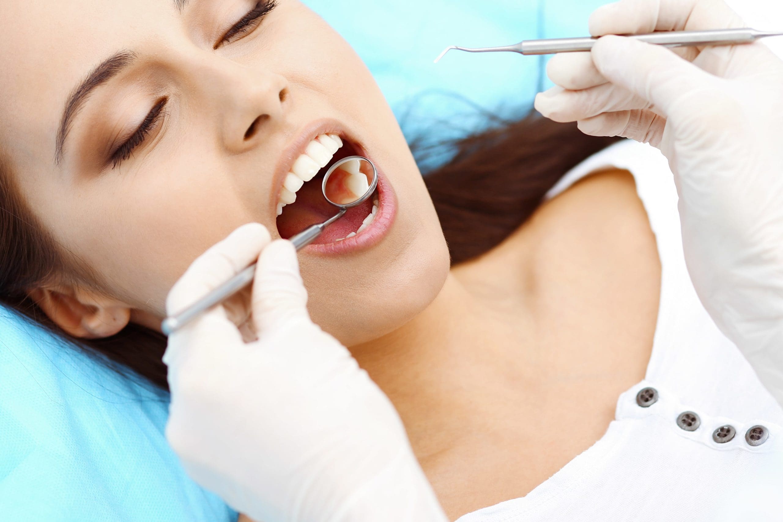 White Fillings – Kensington Court Clinic -bright white smile top image White Fillings - Kensington Court Clinic -bright white smile top image